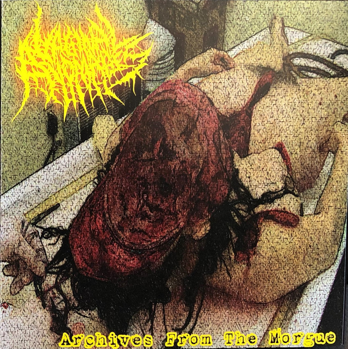 Vaginal Anomalies - Archives From The Morge