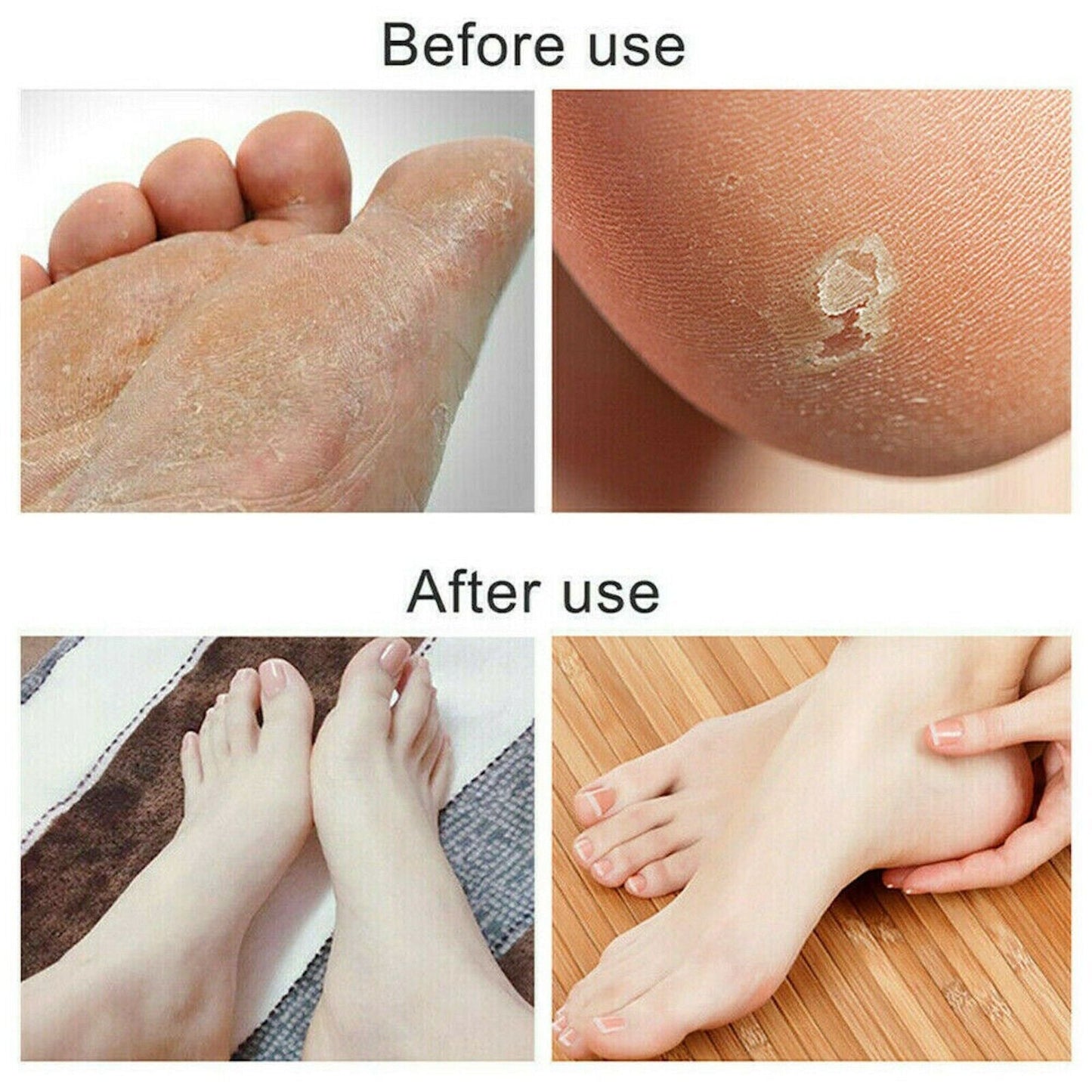 Foot File Scraper Rasp Hard Dead Dry Skin Remover Grater Callus Pedicure Black