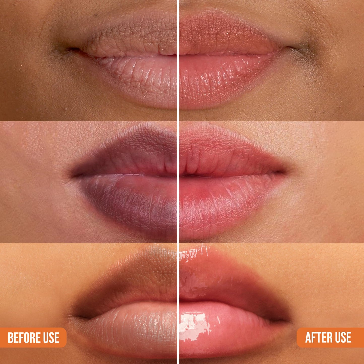 ABERA Dark Lips Corrector Cream - Hydrating Lip Balm & Brightening Lip Scrub
