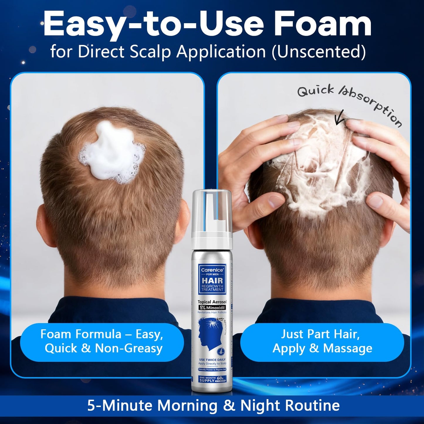 CARENICE 5% Minoxidil Foam for Men with Biotin – Unscented Hair & Beard Growth (6.33 oz)