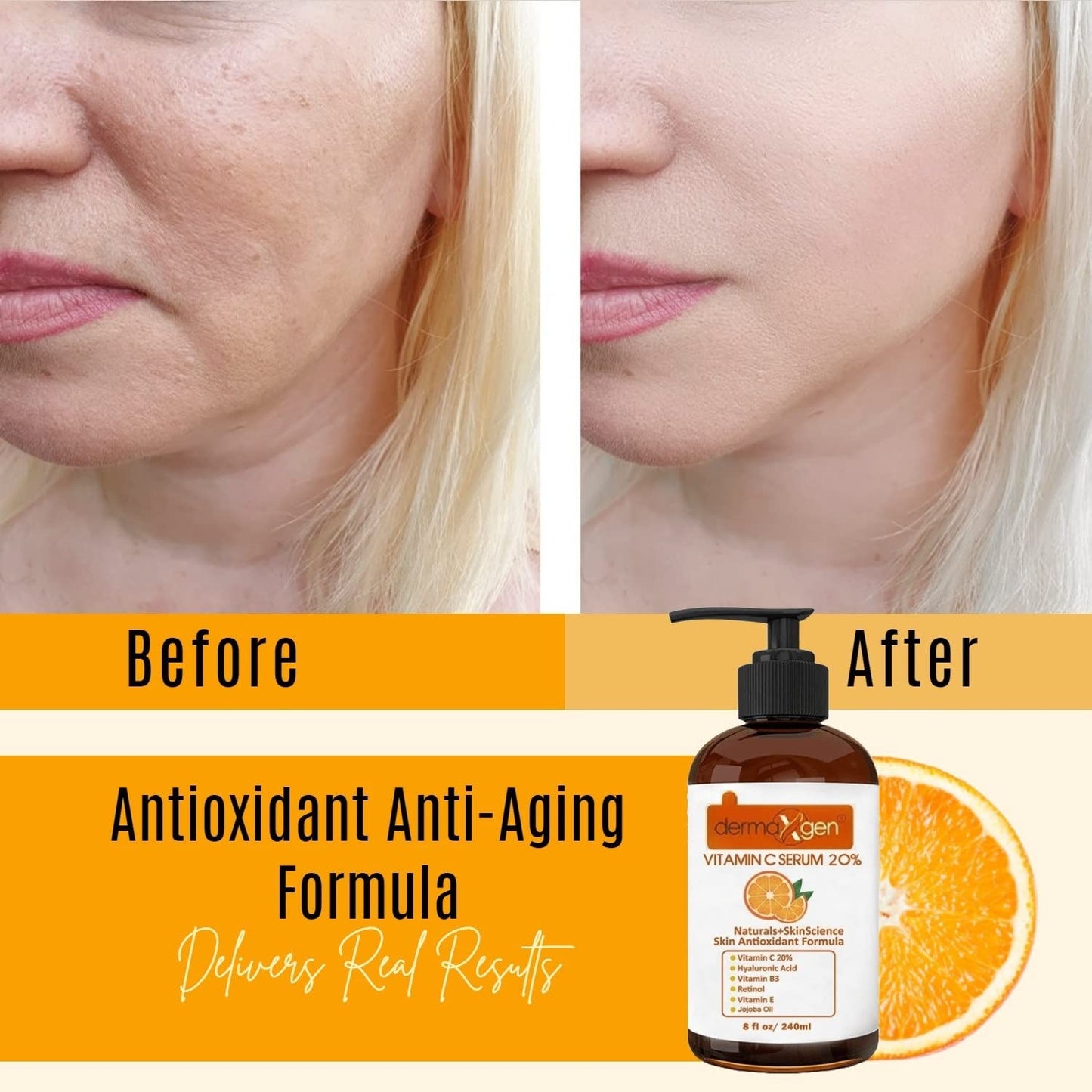 DERMAXGEN Organic 20% Vitamin C Serum for Face – Hyaluronic Acid & Vitamin E – Brightening & Hydration – 8 fl oz