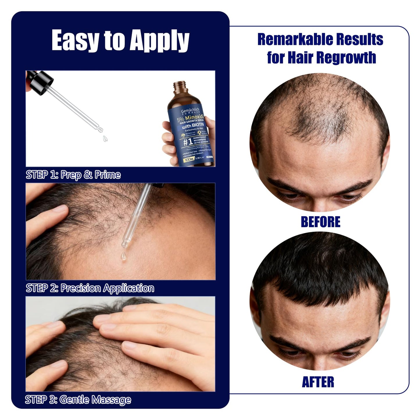 Gemächlich Zu Hause 5% Minoxidil for Men – Biotin, Rosemary & Caffeine, 100ml