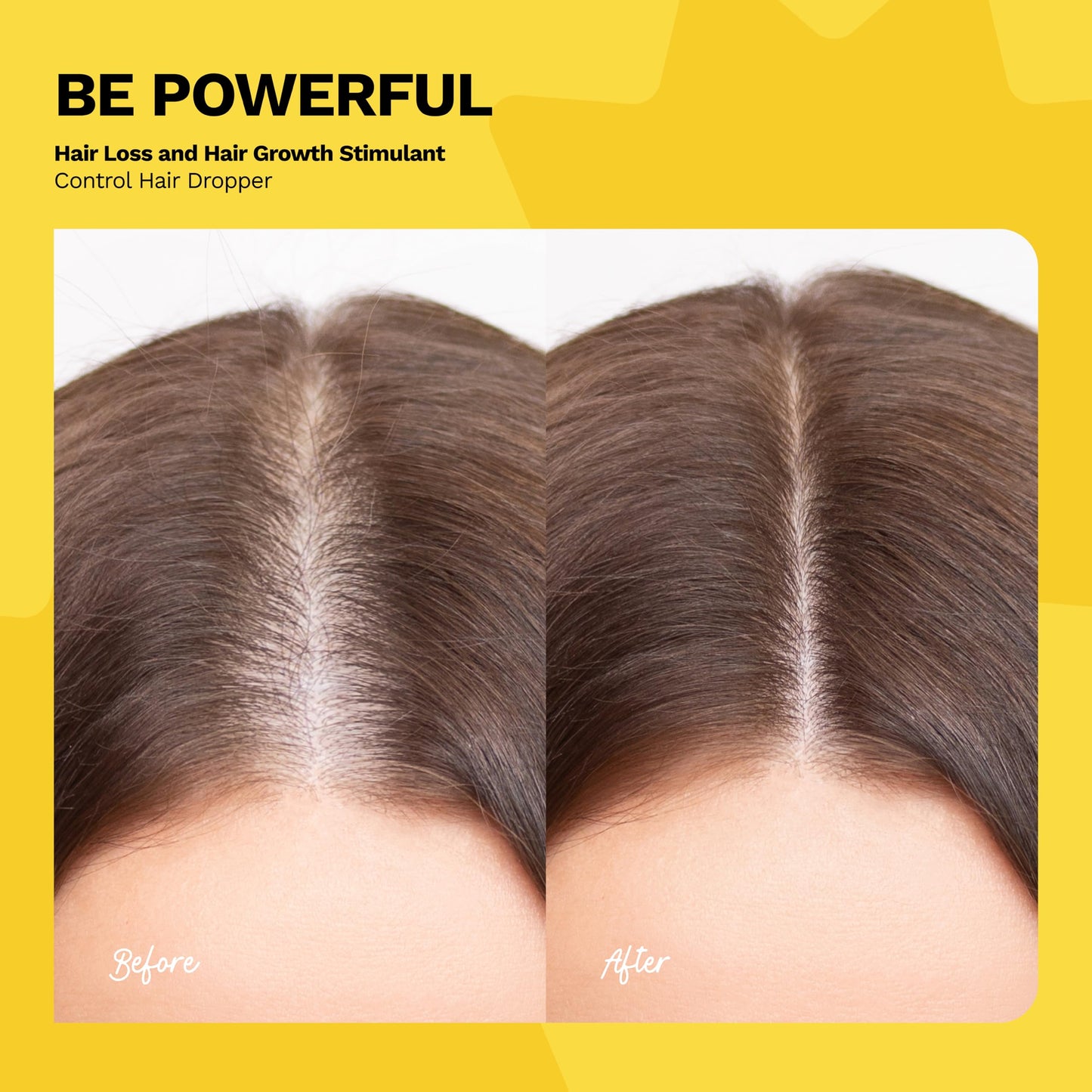 Ginger Root Extract | Growth-Stimulating Drops & Hair Loss Control | Be Powerful Serum (4 oz)