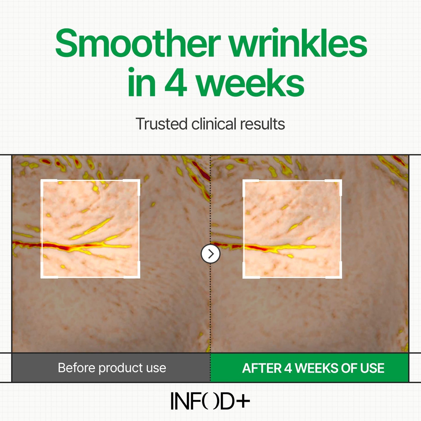 INFODPLUS Korean Skin Care Sensitive Face Cream – Lightweight Ceramides & Panthenol Moisturizer (50ml)