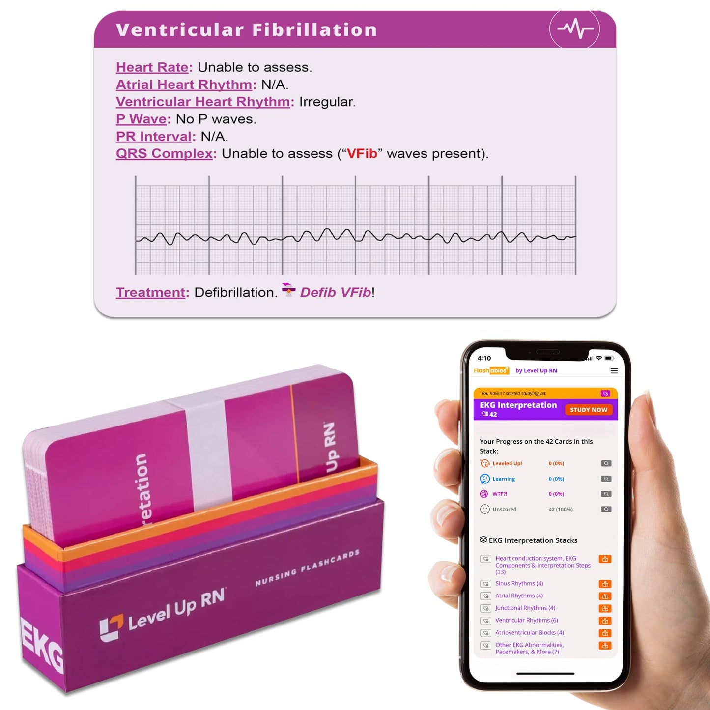 EKG Interpretation Flash Cards – Nursing/EMT/Paramedic | Level Up RN (45 Cards)