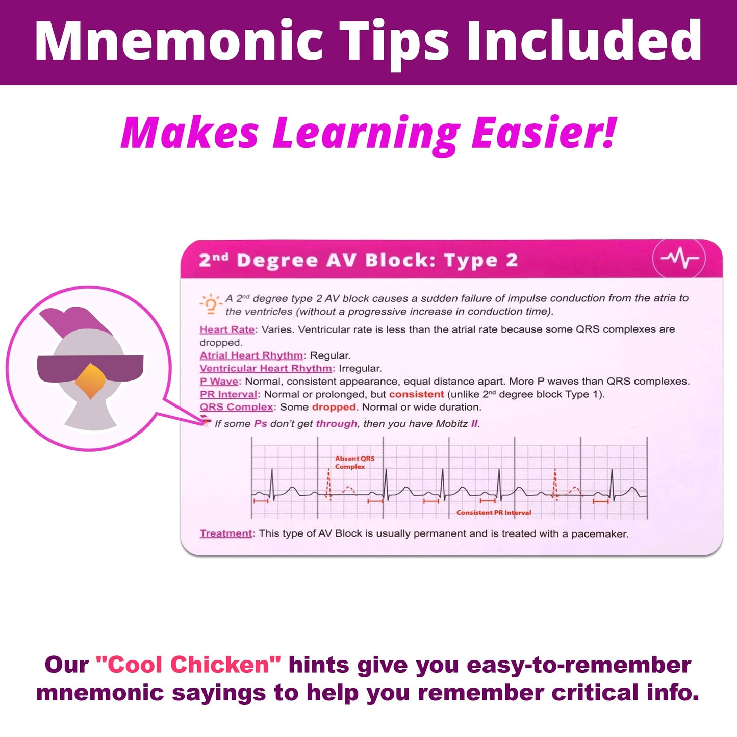 EKG Interpretation Flash Cards – Nursing/EMT/Paramedic | Level Up RN (45 Cards)