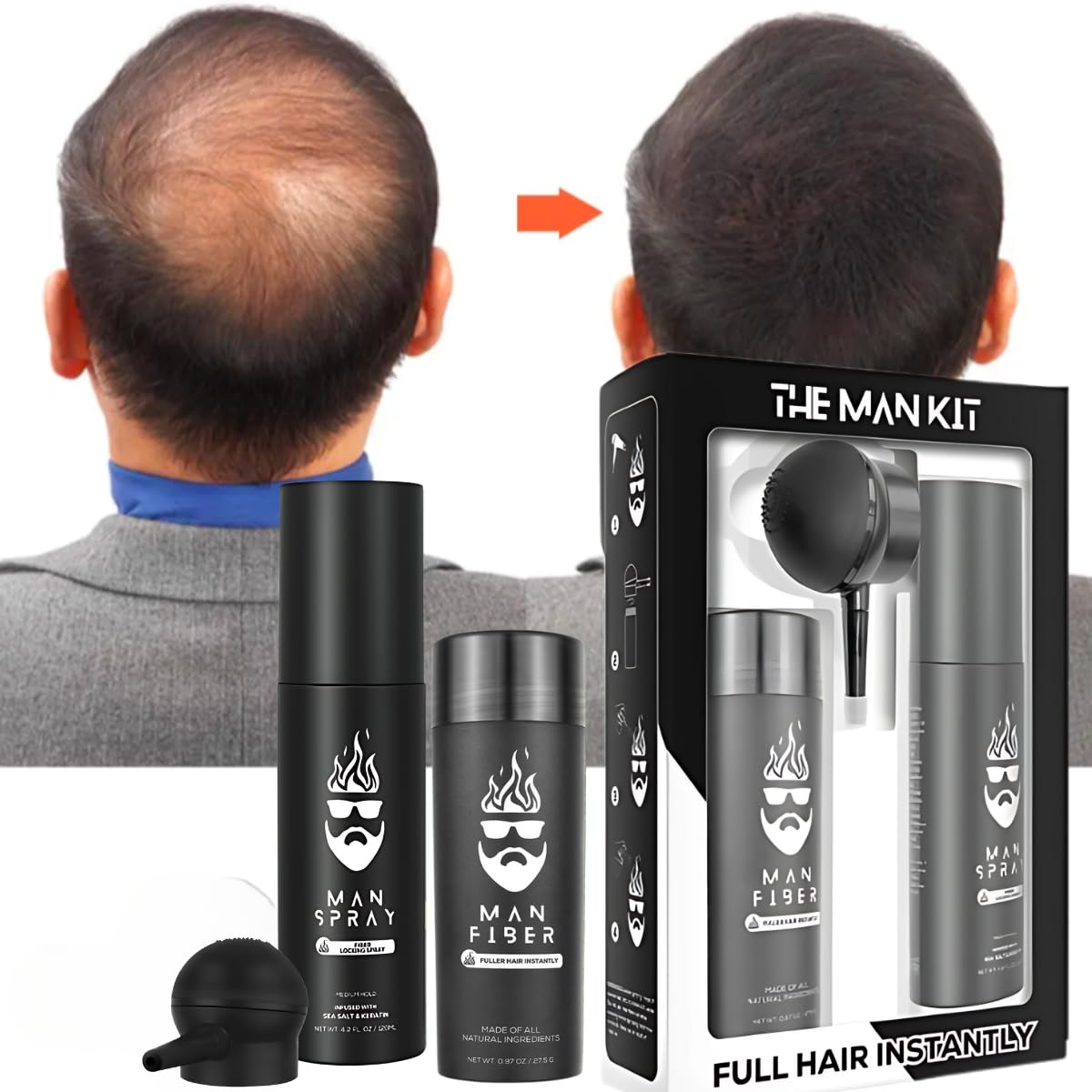 Man Essentials Hair Thickening Fibers (Black) + Locking Spray Kit | Fuller Hair & Beard | Hair Set by The Man Kit