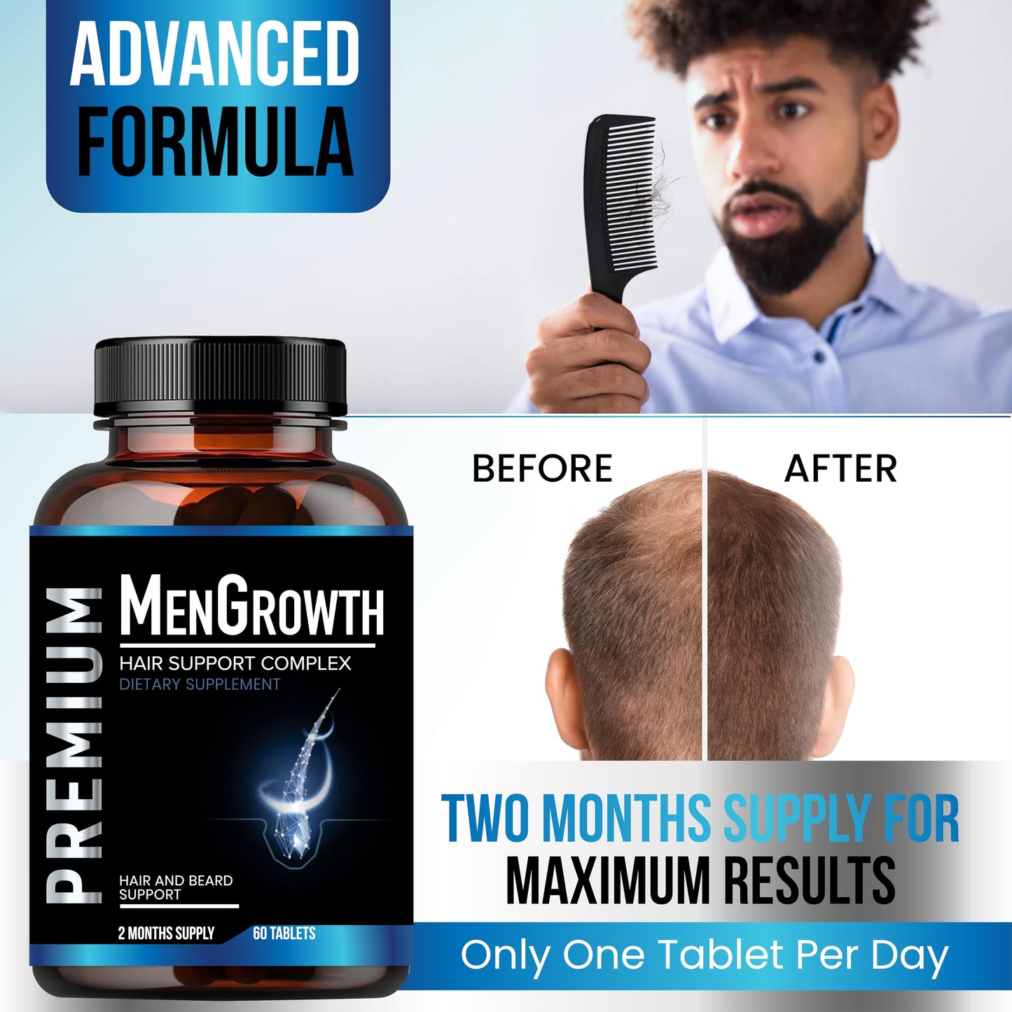 NutraPro MenGrowth Hair Growth Vitamins for Men – Biotin, Saw Palmetto & DHT Blocker