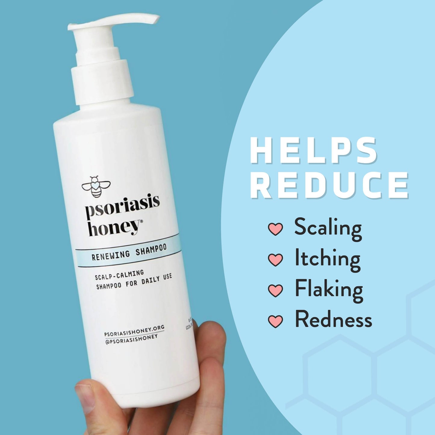 PSORIASIS HONEY Renewing Shampoo — Itchy & Dry Scalp Relief with Argan Oil