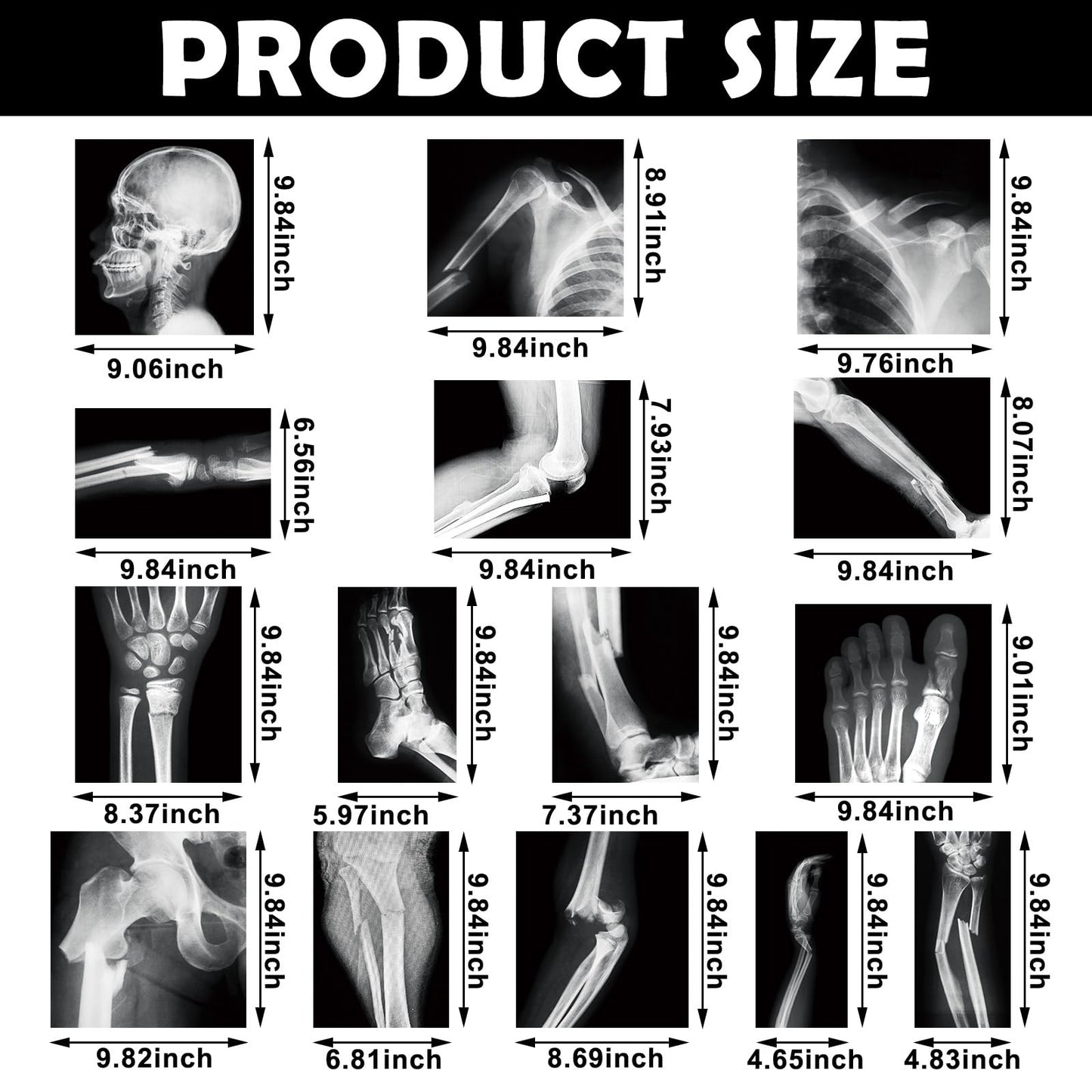 Sayglossy 15 Pcs Broken Bones X-Ray Set for Kids — Realistic PVC Skeleton X-Rays
