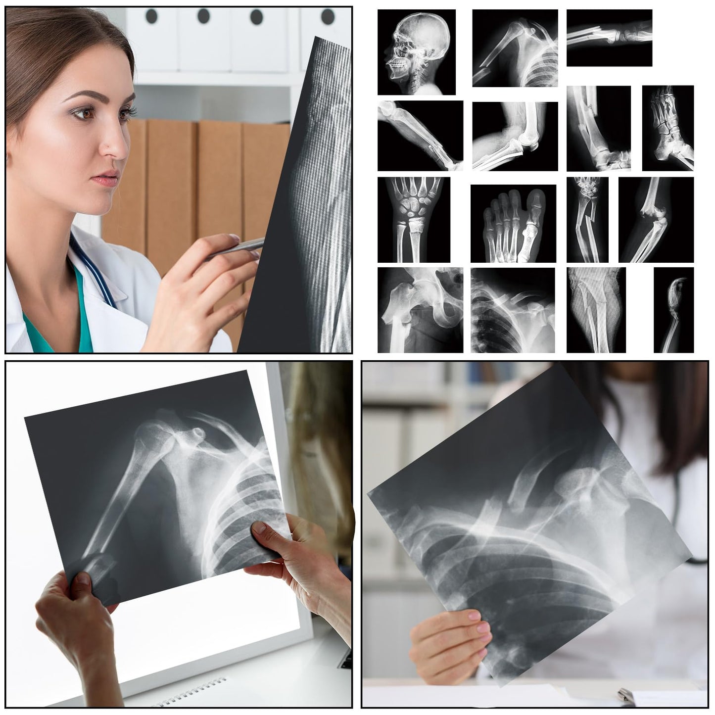 Sayglossy 15 Pcs Broken Bones X-Ray Set for Kids — Realistic PVC Skeleton X-Rays