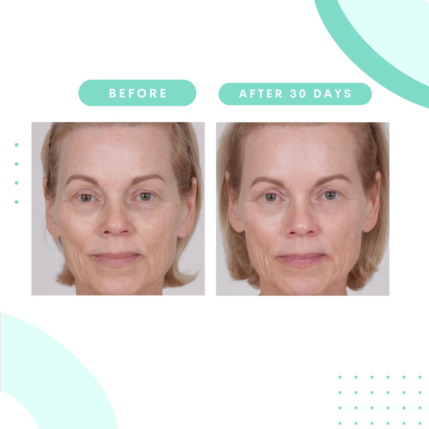 Serious Skincare Glycolic Cleanser – Daily Exfoliating Face Wash with 10% Glycolic