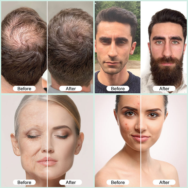 Hair Growth Essence Skin Care Essence Tightener Hair
