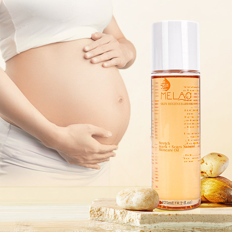 Stretch Marks Repair Oil