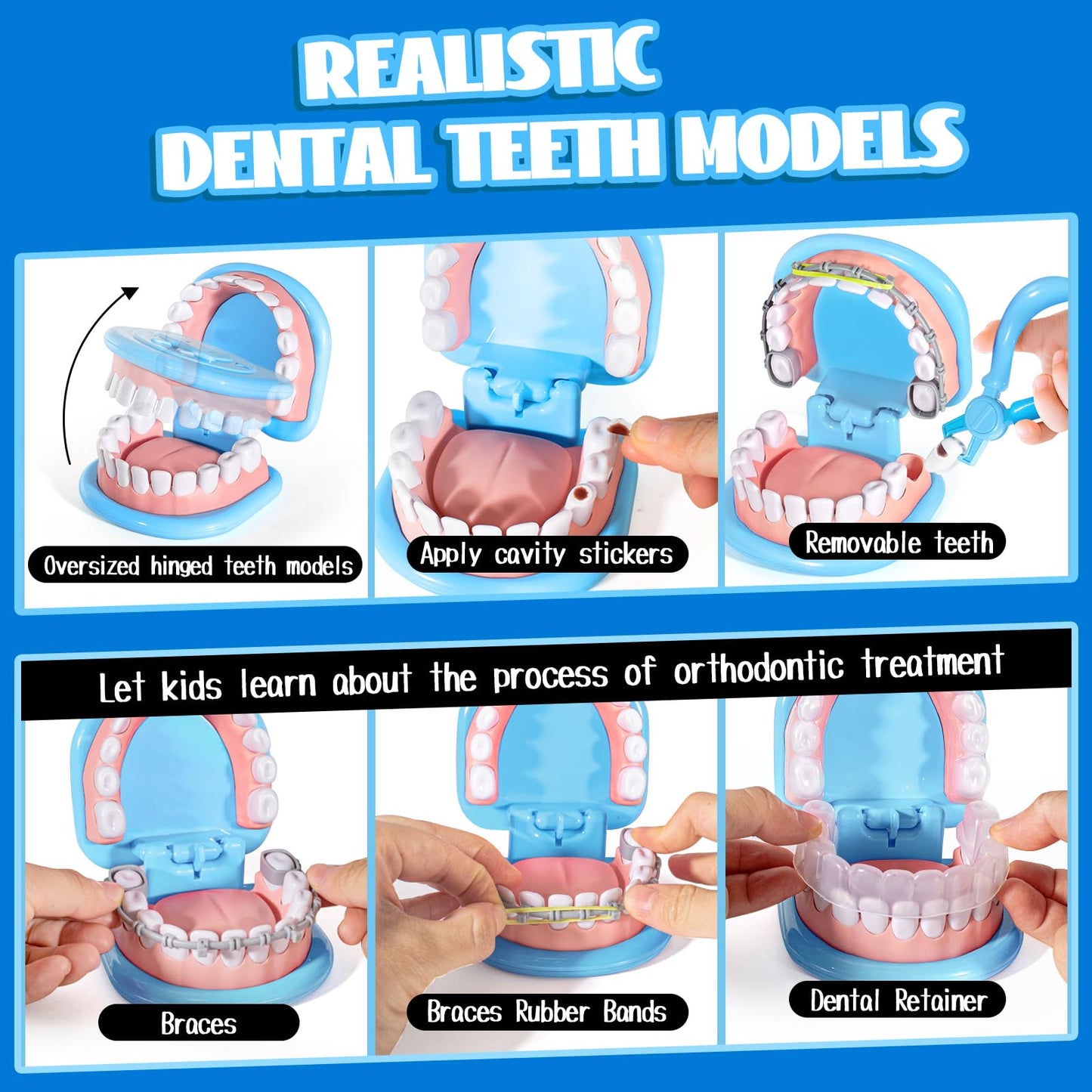 ULOVEME Dentist Playset for Kids 4-6 – Oversized Teeth, Braces & Retainer – Blue