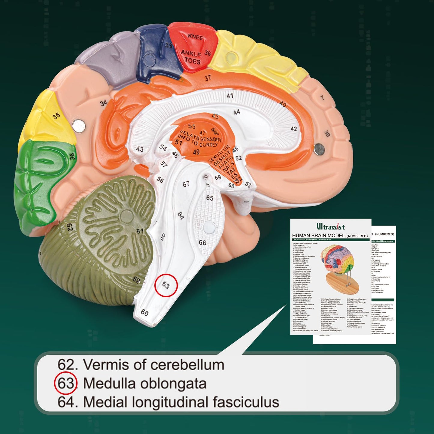 Ultrassist Brain Model – Labeled Neuroanatomy Kit with Study Guide
