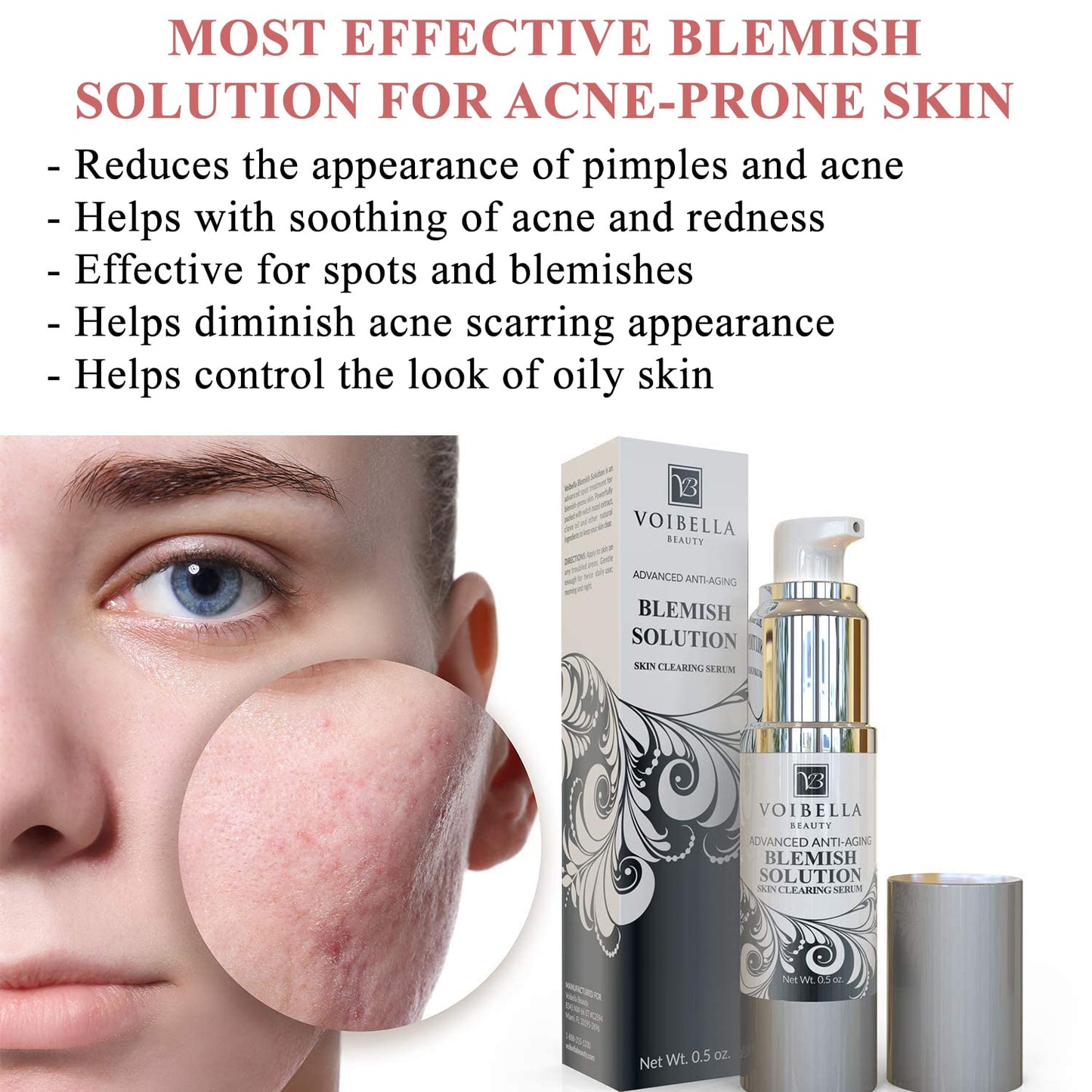 Voibella Beauty Blemish Spot Treatment Cream – Gentle Serum for Acne-Prone Skin